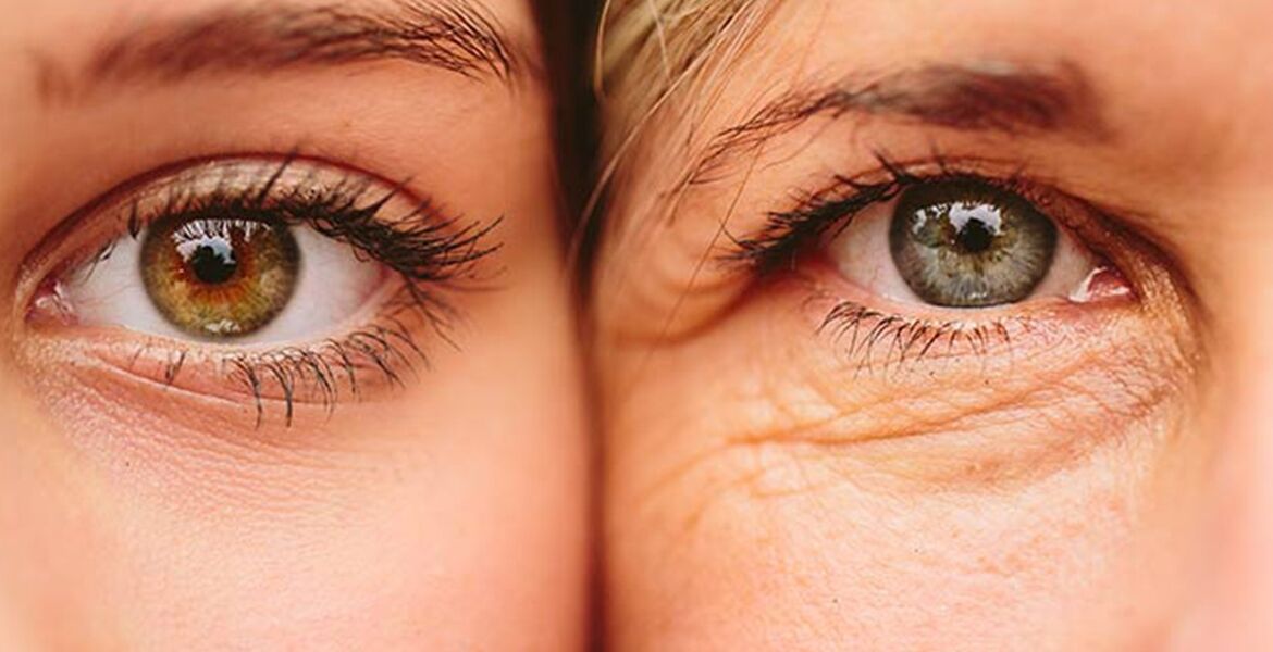 两名不同年龄女性眼部皮肤老化的外部迹象